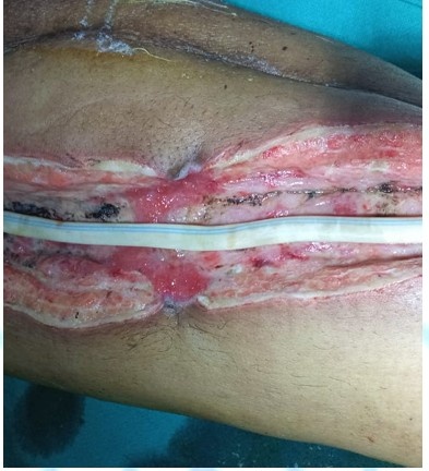 After Treatment