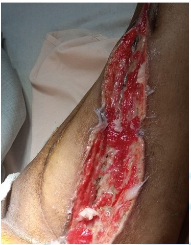 Before Treatment